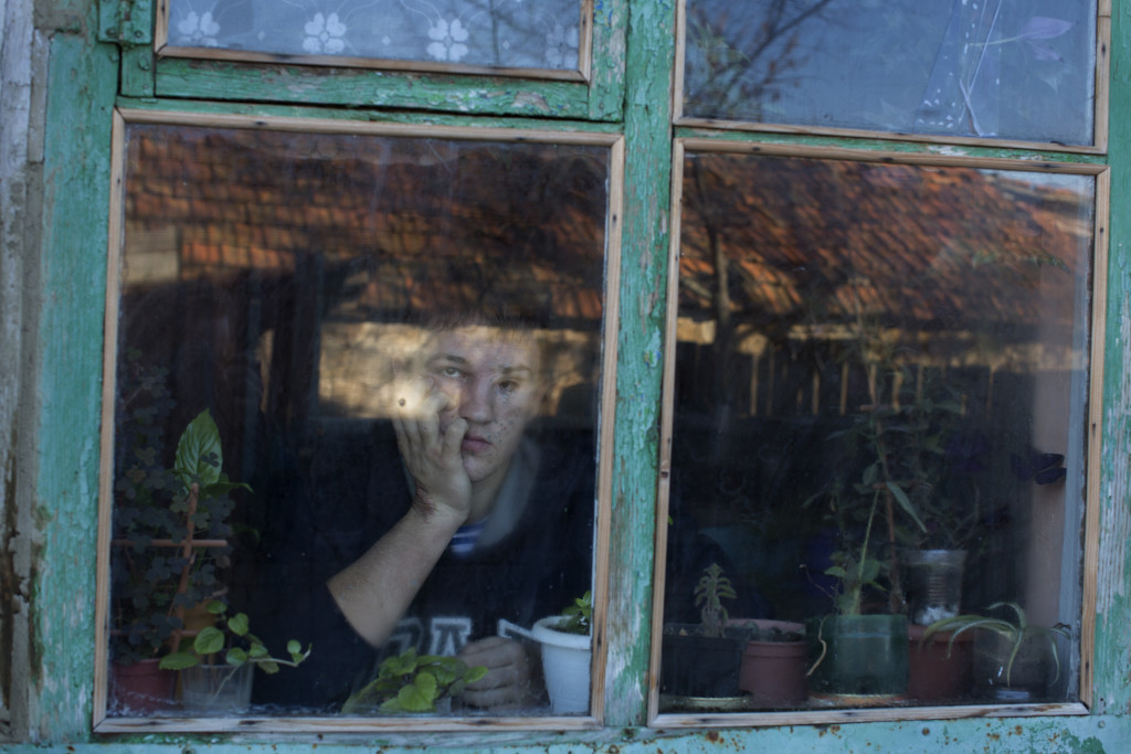 foto : ham : ukraina aleksandr shestak, 17 r, skadad av en mina, d just fyllda 16. han skyddade sin syster nr ngot exploderade utanfr huset p den andra sidan vgen i byn nijne krinskoe.  photo: niclas hammarstrm
