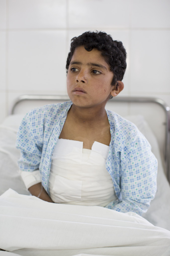 Ehsamallah, 7 år, har svåra skador i bålen. Han har fortfarande, efter flera operationer, inre blödningar i magen.