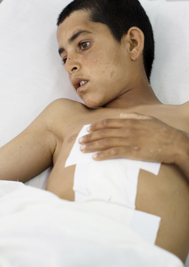 Samiullah, 12 år, har svåra splitterskador i bålen. Hans tarmar är skadade och läkarna har stomiopererat honom. Han är väldigt deprimerad.