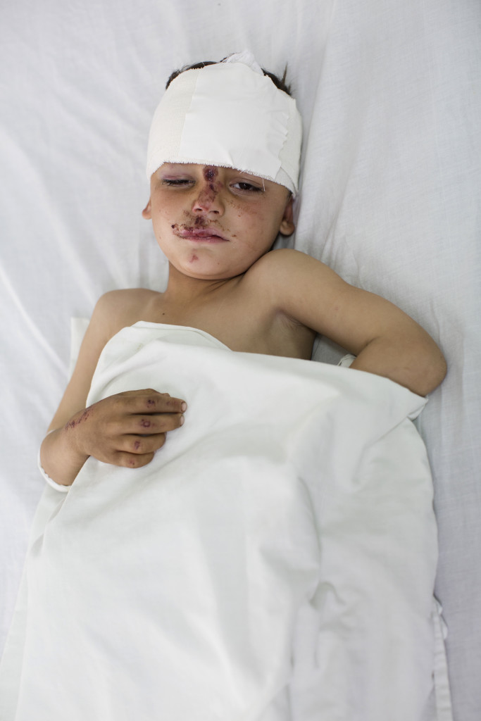 Khalid, 5 år, vårdas för splitterskador.